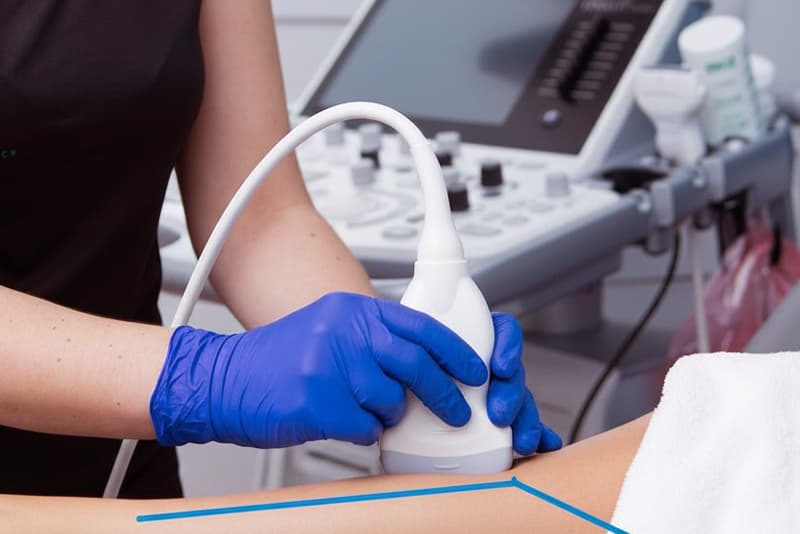 Ecografía musculoesquelética